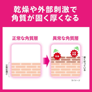 츄메큐어