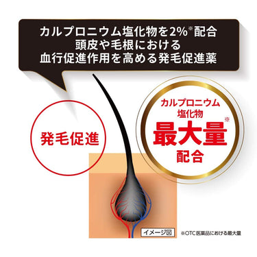 カロヤンプログレ EX 乾燥頭皮用