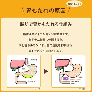 타나베 위장약 우루소