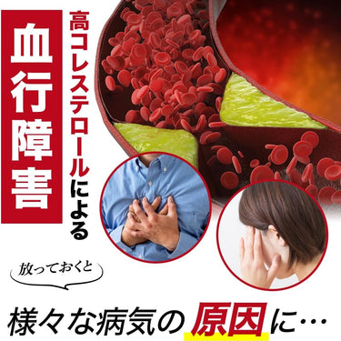 코레스톤