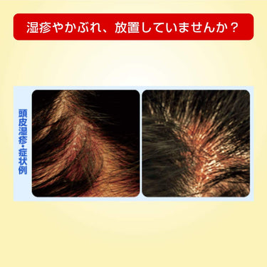 メンソレータム メディクイック H ゴールド
