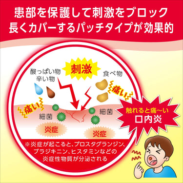 口内炎 パッチ 大正クイックケア